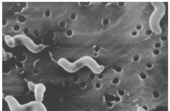 campylobacter jejuni